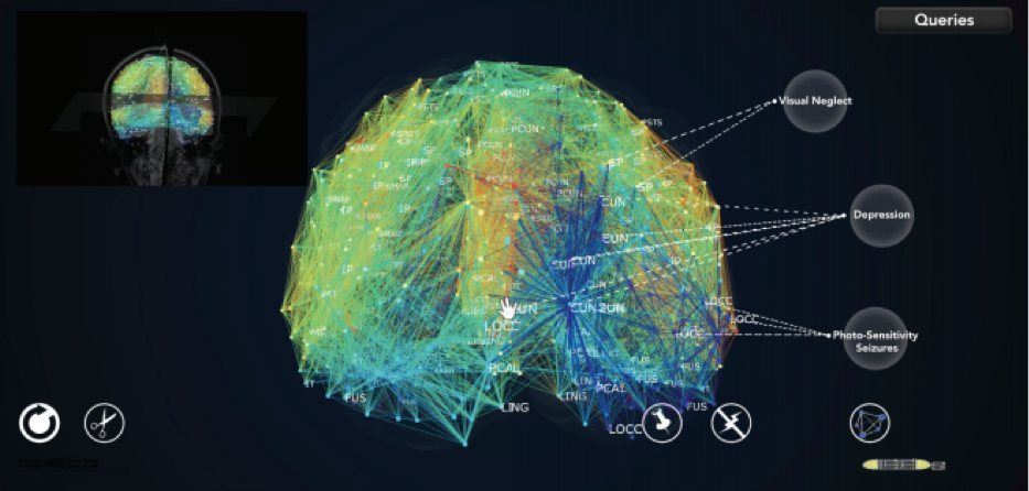 BrainX3 interactive 3D visualisation of the human brain connectome
